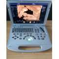 DW-C60plus Tragbarer Farb-Doppler-Fetal-Ultraschall